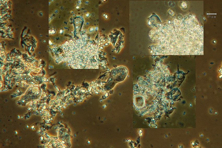 Dendrothele tetracornis Boidin & Duhem